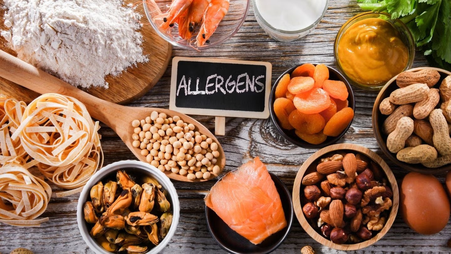 Nutrition Frequently Asked Questions